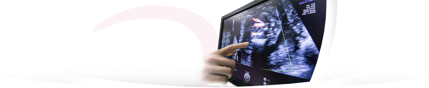 Špičková ultrazvuková diagnostika