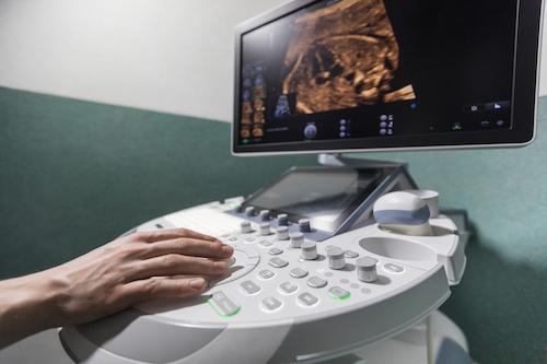 Fetální echokardiografie