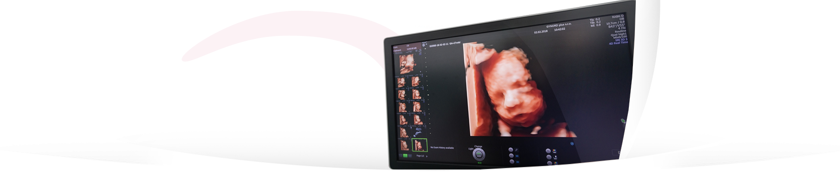 Nejkrásnější 3D/4D ultrazvuk